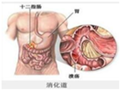 治疗技术攻克“癌王”--胰腺癌