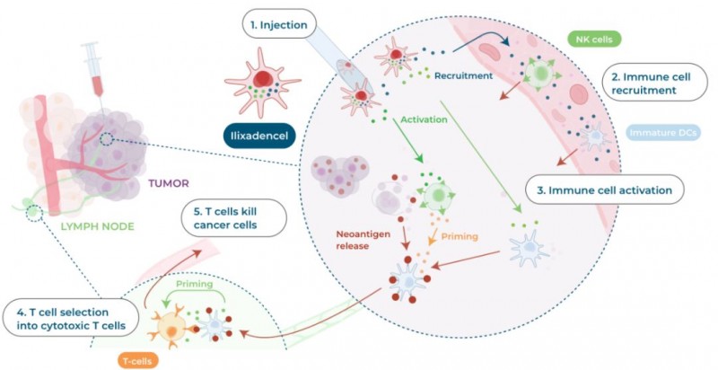 新型DC疫苗ilixadencel的抗癌原理