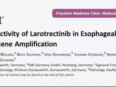食道癌新药,食管癌靶向药物拉罗替尼临床案例治疗效果良好
