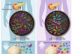 粪菌移植治疗肿瘤癌症,菌群直接影响胰腺癌患者的生存,如何调节肠道菌群