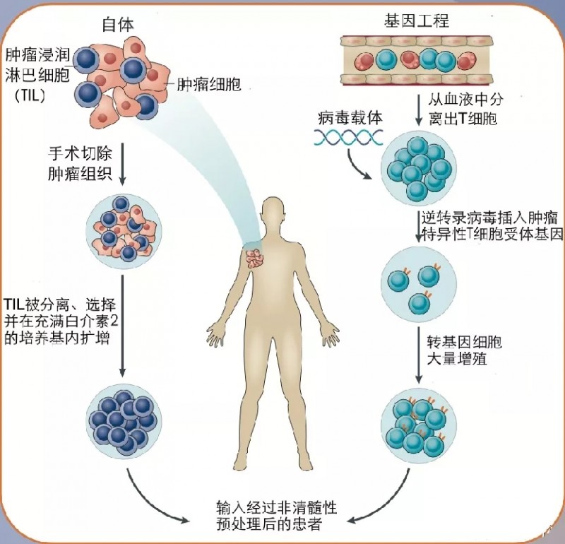 肿瘤til疗法