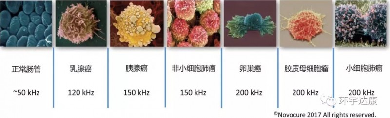 电场治疗效果较好的7种实体瘤