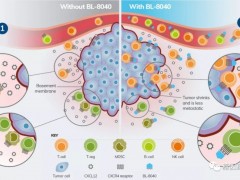 2020年转移性胰腺癌治疗新疗法,PD1免疫联合靶向治疗,K药+BL-8040(Motixafortide)疗效令人鼓舞