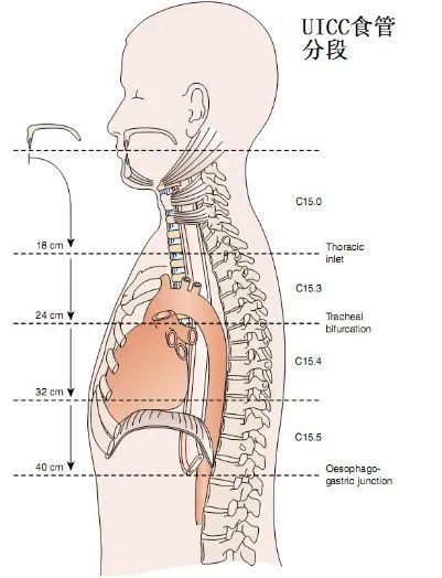 UICC食管分段