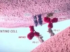 PD-L1抑制剂Durvalumab（IMFINZI）临床使用指南！