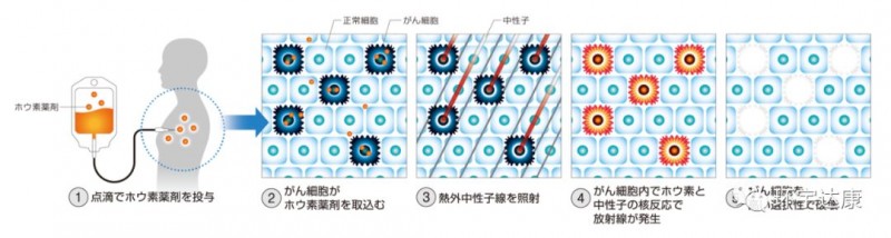 硼中子治疗原理