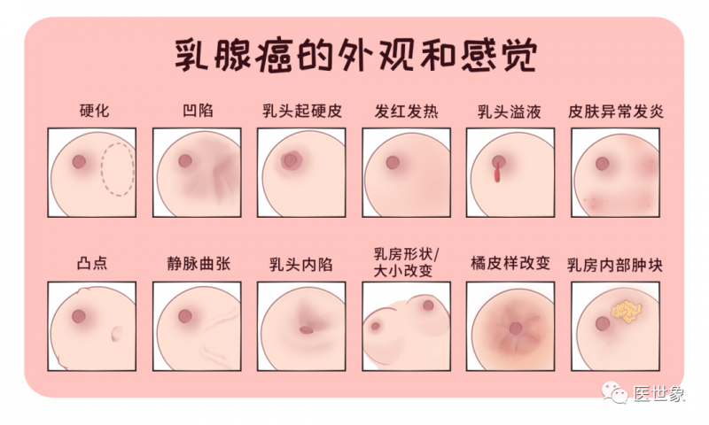 乳腺癌的外观和感觉