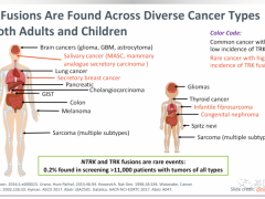 分泌性乳腺癌靶向治疗,分泌性乳腺癌是最有可能获益于NTRK基因突变靶向药治疗的癌种之一