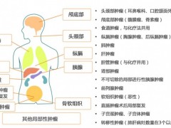 质子治疗适应症