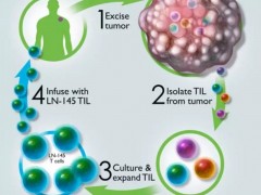 新型"定制款"肿瘤浸润淋巴细胞til疗法显著延长晚期肺癌生存期