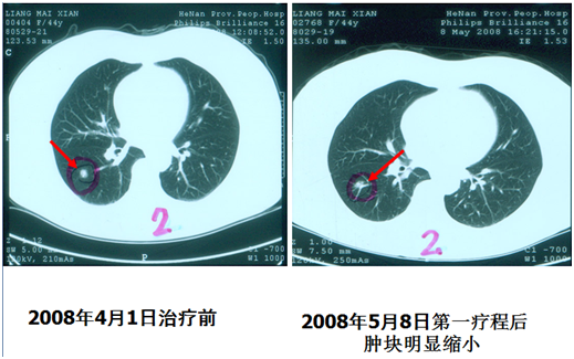 QQ图片20160322165430