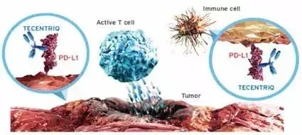 肿瘤浸润性免疫细胞