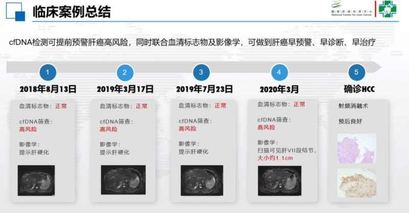 和瑞基因莱思宁临床案例总结