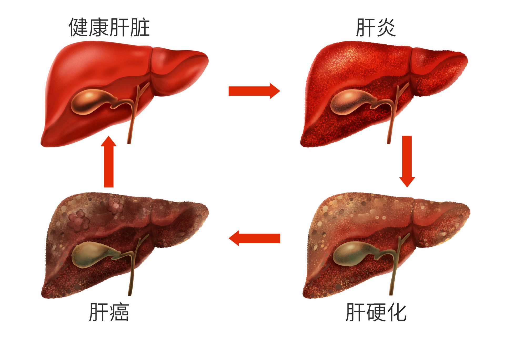 肝脏病变