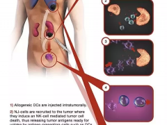 美国MD安德森新型树突疫苗治疗晚期癌症临床研究 无进展生存期是常规治疗的3倍